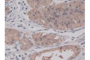 Detection of RALA in Human Stomach Tissue using Monoclonal Antibody to V-Ral Simian Leukemia Viral Oncogene Homolog A (RALA) (rala antibody  (AA 1-206))