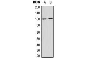 Western blot analysis of NF-kappaB p100 (pS865) expression in HeLa (A), MCF7 (B) whole cell lysates. (NFKB2 antibody  (C-Term, pSer865))