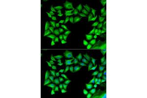 Immunofluorescence analysis of U2OS cells using TIMP4 antibody (ABIN5973817). (TIMP4 antibody)