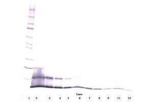 Image no. 1 for anti-Chemokine (C-C Motif) Ligand 5 (CCL5) antibody (ABIN465753) (CCL5 antibody)