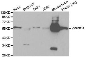 Western blot analysis of extracts of various cell lines, using PPP3CA antibody. (PPP3CA antibody  (AA 1-511))