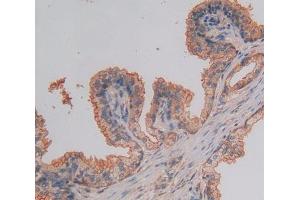 Used in DAB staining on fromalin fixed paraffin- embedded prostate gland tissue (NUP37 antibody  (AA 34-279))