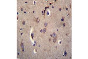 Formalin fixed and paraffin embedded human brain tissue stained with DTNA / DRP3 Antibody (C-term) followed by peroxidase conjugation of the secondary antibody and DAB staining. (DTNA antibody  (C-Term))