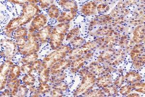 Immunohistochemistry analysis of paraffin-embedded mouse kidney using,DAK (ABIN7073737) at dilution of 1: 5000