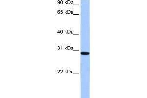 WB Suggested Anti-RALYL Antibody Titration:  0. (RALYL antibody  (C-Term))