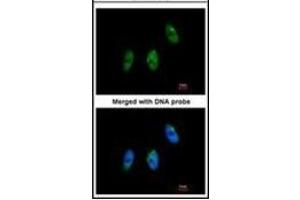 Immunofluorescence analysis of paraformaldehyde-fixed HeLa, using ELP3 antibody at 1/100 dilution. (ELP3/KAT9 antibody)