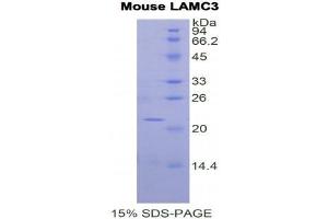 SDS-PAGE (SDS) image for Laminin, gamma 3 (LAMC3) (AA 1250-1418) protein (His tag) (ABIN1877967) (LAMC3 Protein (AA 1250-1418) (His tag))