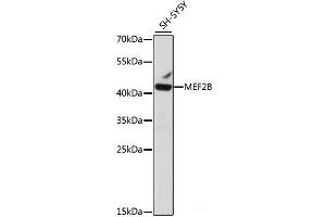 Western blot analysis of extracts of SH-SY5Y cells using MEF2B Polyclonal Antibody at dilution of 1:1000. (MEF2B antibody)