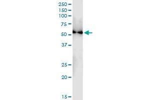 Immunoprecipitation of TUBB4Q transfected lysate using anti-TUBB4Q MaxPab rabbit polyclonal antibody and Protein A Magnetic Bead , and immunoblotted with TUBB4Q MaxPab mouse polyclonal antibody (B01) . (TUBB7P antibody  (AA 1-434))