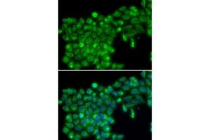 Immunofluorescence analysis of MCF7 cell using TNFSF13 antibody. (TNFSF13 antibody)
