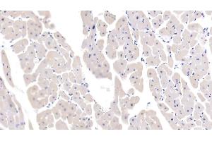 Detection of IL13 in Porcine Cardiac Muscle Tissue using Polyclonal Antibody to Interleukin 13 (IL13) (IL-13 antibody  (AA 25-131))