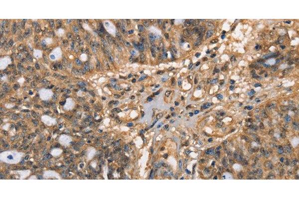 HK3 antibody