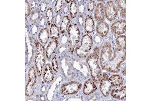Immunohistochemical staining (Formalin-fixed paraffin-embedded sections) of human kidney with NUDT7 polyclonal antibody  shows strong cytoplasmic positivity in granular pattern in tubular cells.