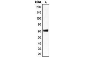 Western blot analysis of CLCC1 expression in HepG2 (A) whole cell lysates. (CLCC1 antibody  (Center))