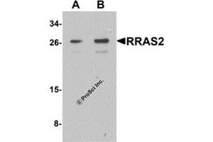 Western Blotting (WB) image for anti-Related RAS Viral (R-Ras) Oncogene Homolog 2 (RRAS2) (C-Term) antibody (ABIN1077448) (RRAS2 antibody  (C-Term))