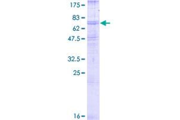 beta 2 Adrenergic Receptor Protein (AA 1-413) (GST tag)