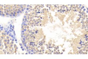 Detection of FBLN1 in Mouse Testis Tissue using Polyclonal Antibody to Fibulin 1 (FBLN1) (Fibulin 1 antibody  (AA 399-578))