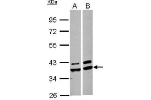 WB Image Sample (30 ug of whole cell lysate) A: A549 B: HepG2 10% SDS PAGE antibody diluted at 1:1000 (AKR1A1 antibody)
