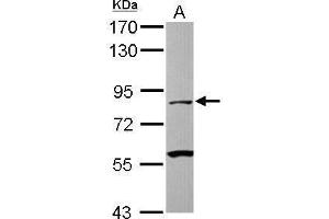 WB Image Sample (30 ug of whole cell lysate) A: Jurkat 7. (CAPN1 antibody)