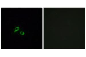 Immunofluorescence analysis of MCF-7 cells, using GIPR antibody.