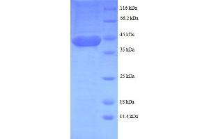 LMO1 Protein (AA 5-156, partial) (GST tag)