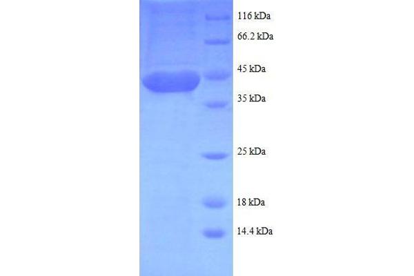 LMO1 Protein (AA 5-156, partial) (GST tag)