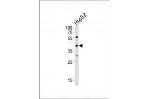 Western Blotting (WB) image for anti-LIM Homeobox 1 (LHX1) (AA 332-365), (C-Term) antibody (ABIN3028802)