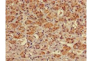 Immunohistochemistry of paraffin-embedded human adrenal gland tissue using ABIN7174961 at dilution of 1:100 (Myosin VIIA antibody  (AA 838-968))