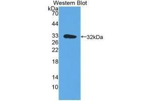 Detection of recombinant HLA-DRA using Polyclonal Antibody to HLA Class II Histocompatibility Antigen, DR Alpha Chain (HLA-DRA) (HLA-DRA antibody  (AA 25-216))