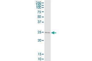 IGF2 MaxPab rabbit polyclonal antibody. (IGF2 antibody  (AA 1-180))