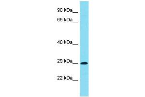 Host: Rabbit Target Name: C7orf57 Sample Type: Jurkat Whole Cell lysates Antibody Dilution: 1.