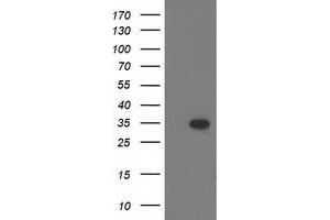 Image no. 1 for anti-CTD (Carboxy-terminal Domain, RNA Polymerase II, Polypeptide A) Small Phosphatase 1 (CTDSP1) antibody (ABIN1497677) (CTDSP1 antibody)