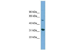 WB Suggested Anti-YIPF2 Antibody Titration:  0. (YIPF2 antibody  (Middle Region))