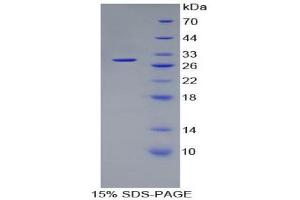 SDS-PAGE (SDS) image for Proteasome (Prosome, Macropain) 26S Subunit, Non-ATPase, 10 (PSMD10) (AA 1-226) protein (His tag) (ABIN1879285) (PSMD10 Protein (AA 1-226) (His tag))
