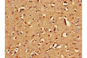 Immunohistochemistry of paraffin-embedded human brain tissue using ABIN7154332 at dilution of 1:100 (BLZF1 antibody  (AA 11-99))