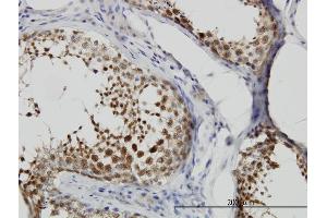 Immunoperoxidase of monoclonal antibody to CSE1L on formalin-fixed paraffin-embedded human testis. (Exportin 2 antibody  (AA 872-971))