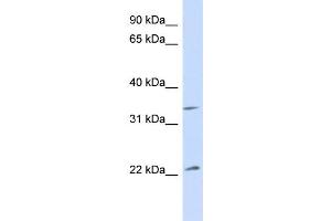 WB Suggested Anti-ARF1 Antibody Titration: 1. (ARF1 antibody  (Middle Region))