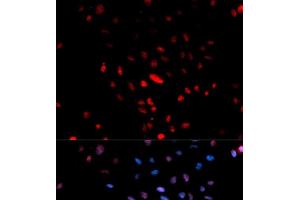 Immunofluorescence analysis of U2OS cells using Phospho-c-Jun(S73) Polyclonal Antibody (C-JUN antibody  (pSer73))