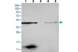 Western blot analysis of Lane 1: RT-4, Lane 2: U-251 MG, Lane 3: Human Plasma, Lane 4: Liver, Lane 5: Tonsil with CCBL2 polyclonal antibody .