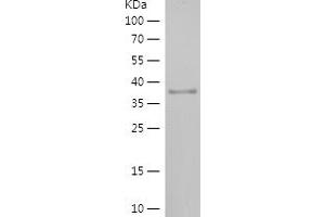 Western Blotting (WB) image for Ribonuclease P/MRP 21kDa Subunit (RPP21) (AA 96-154) protein (His-IF2DI Tag) (ABIN7282771) (RPP21 Protein (AA 96-154) (His-IF2DI Tag))