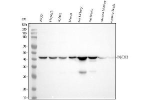 Western blot analysis of UQCRC2 using anti-UQCRC2 antibody (ABIN7606652).