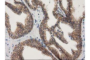 Image no. 2 for anti-Catenin (Cadherin-Associated Protein), beta 1, 88kDa (CTNNB1) antibody (ABIN1496888) (CTNNB1 antibody)