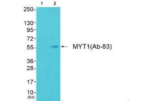 Western Blotting (WB) image for anti-Myelin Transcription Factor 1 (MYT1) (Ser83) antibody (ABIN1848243) (MYT1 antibody  (Ser83))