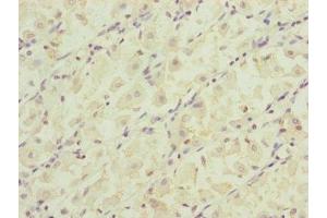 RARS2 antibody  (AA 17-340)