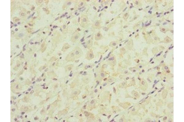 RARS2 antibody  (AA 17-340)