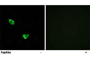 Immunofluorescence analysis of MCF-7 cells, using CHPF polyclonal antibody . (CHPF antibody)