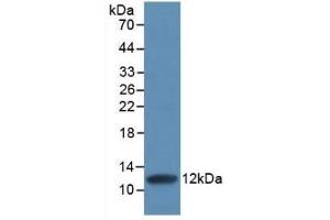Detection of Recombinant IL8, Human using Monoclonal Antibody to Interleukin 8 (IL8) (IL-8 antibody  (AA 28-99))