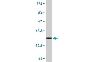 Western Blot detection against Immunogen (37. (MIPOL1 antibody  (AA 321-423))