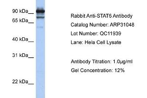 WB Suggested Anti-STAT6 Antibody Titration:  1 ug/ml  Positive Control:  Hela cell lysate STAT6 is strongly supported by BioGPS gene expression data to be expressed in Human HeLa cells (STAT6 antibody  (C-Term))