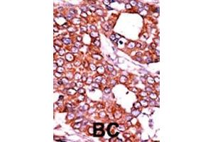 Immunohistochemistry (Paraffin-embedded Sections) (IHC (p)) image for anti-Cell Division Cycle 25 Homolog A (S. Pombe) (CDC25A) (AA 480-514), (pThr507) antibody (ABIN389532)